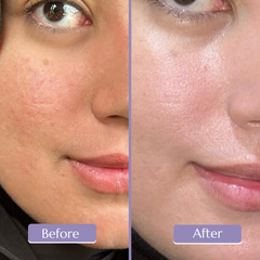 Watermelon Bright Jelly Cleanser