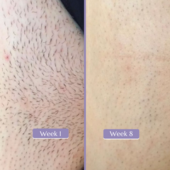 Serenity+ Multifunction IPL Hair Removal Handset