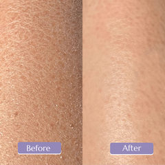 Before and after comparison of skin after using Setosa Skin Exfoliating glove with real results