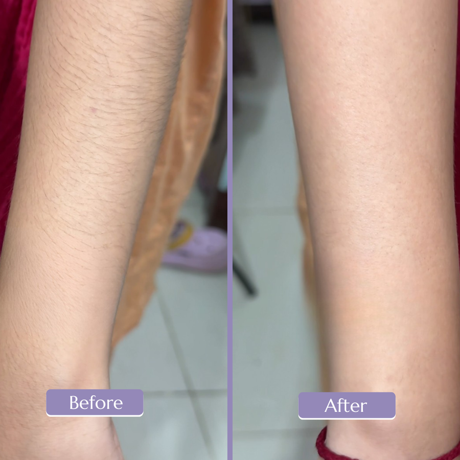 Before and after, Fatima
