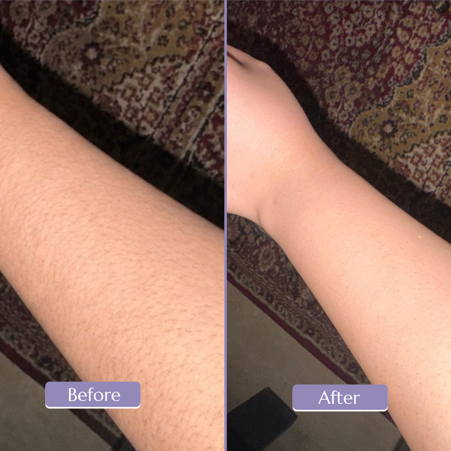 Before and after shared by Ayesha K.