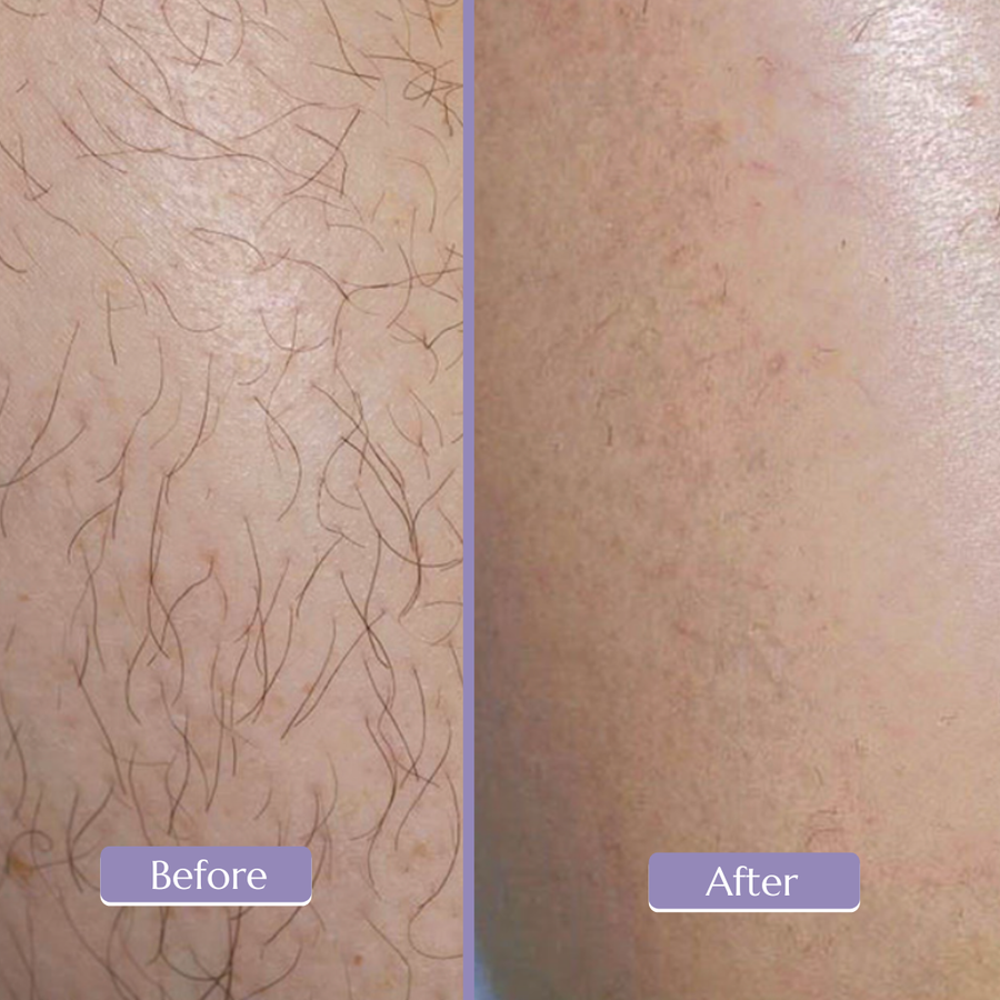 Before and after shared by Mahnoor A.