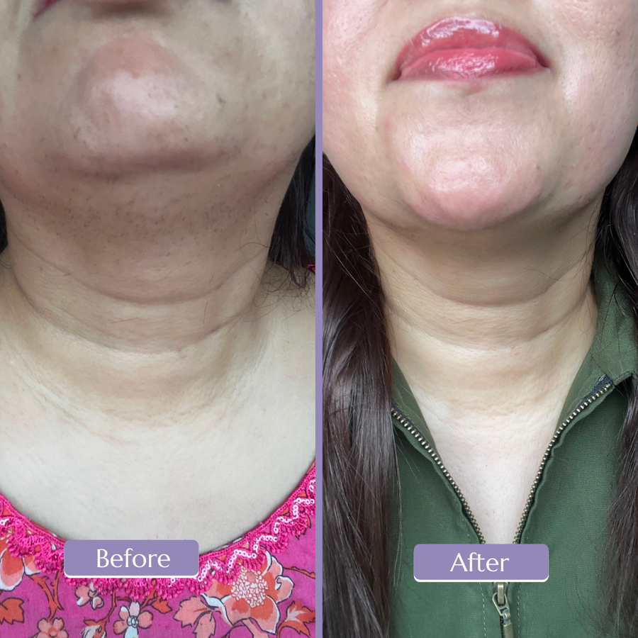 Before and after, Ayesha